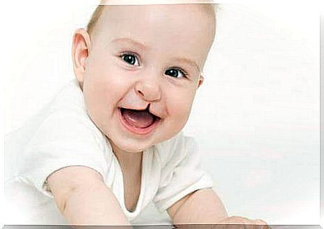 Cleft lip can be detected before pregnancy.