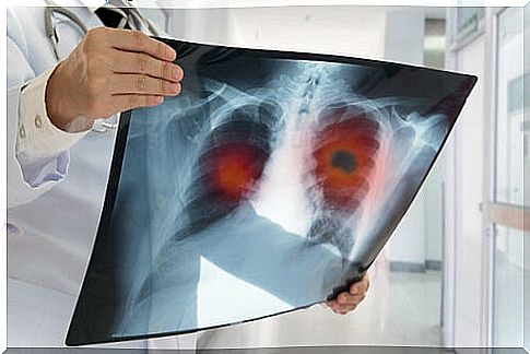 X-rays to examine the lungs.