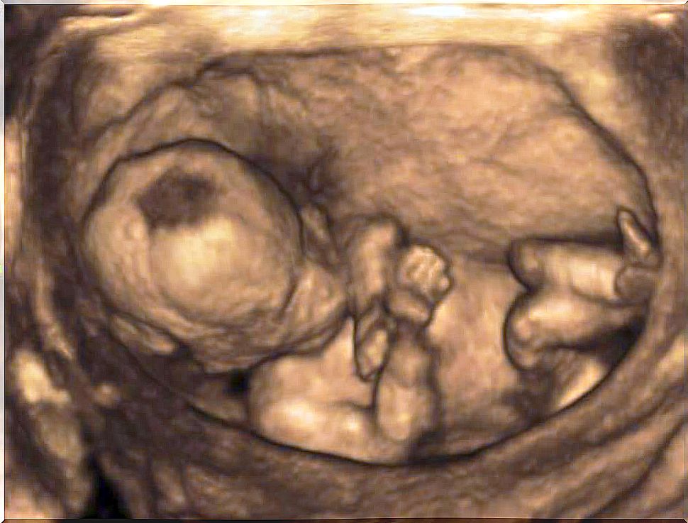 Ultrasound of a baby.