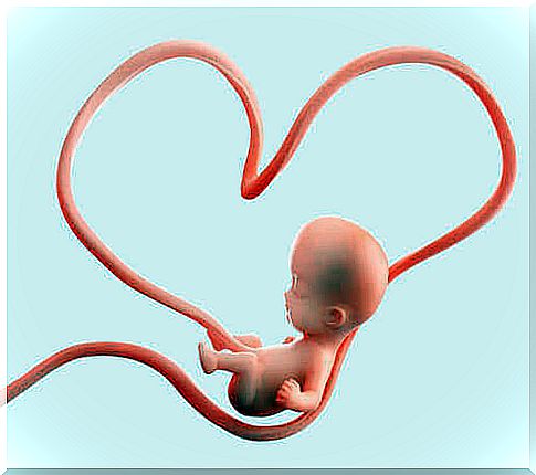 Umbilical cord complications: data to consider